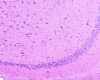 EndplateGliosis